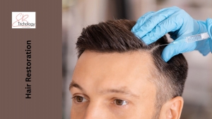What Are The 5 Benefits Of Having Invasive Hair Restoration Treatment?
